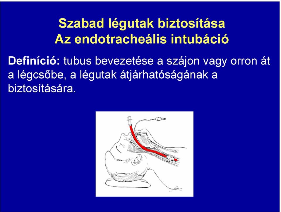 tubus bevezetése a szájon vagy orron át