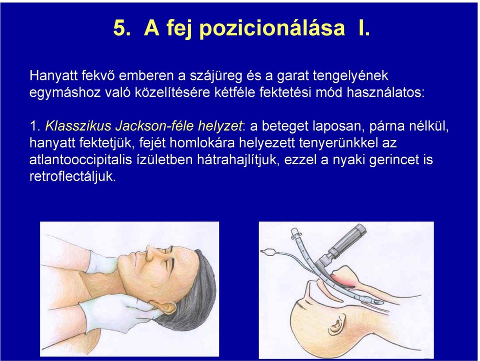 kétféle fektetési mód használatos: 1.