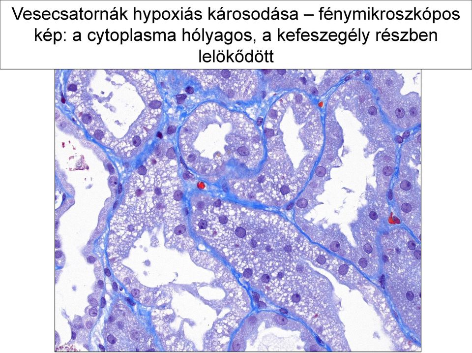 kép: a cytoplasma hólyagos,