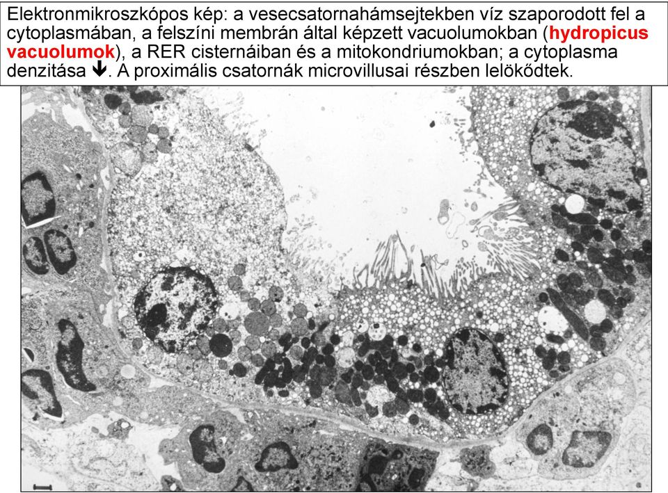 (hydropicus vacuolumok), a RER cisternáiban és a mitokondriumokban; a