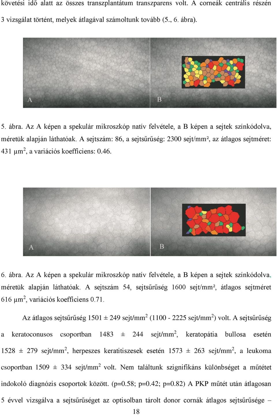 A sejtszám: 86, a sejtsűrűség: 2300 sejt/mm², az átlagos sejtméret: 431 µm 2, a variációs koefficiens: 0.46. 6. ábra.