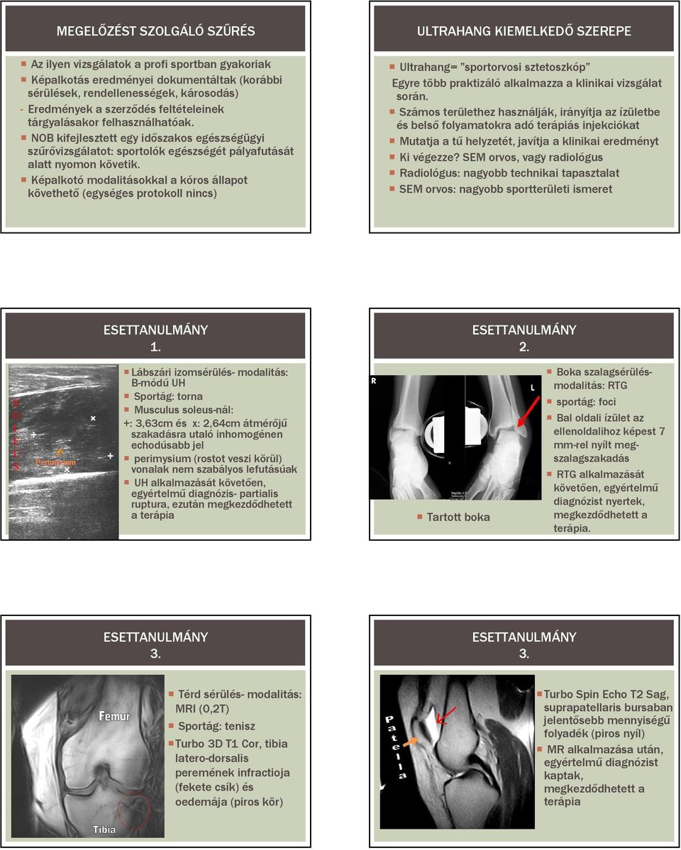 Képalkotó modalitásokkal a kóros állapot követhetı (egységes protokoll nincs) ULTRAHANG KIEMELKEDİ SZEREPE Ultrahang= sportorvosi sztetoszkóp Egyre több praktizáló alkalmazza a klinikai vizsgálat