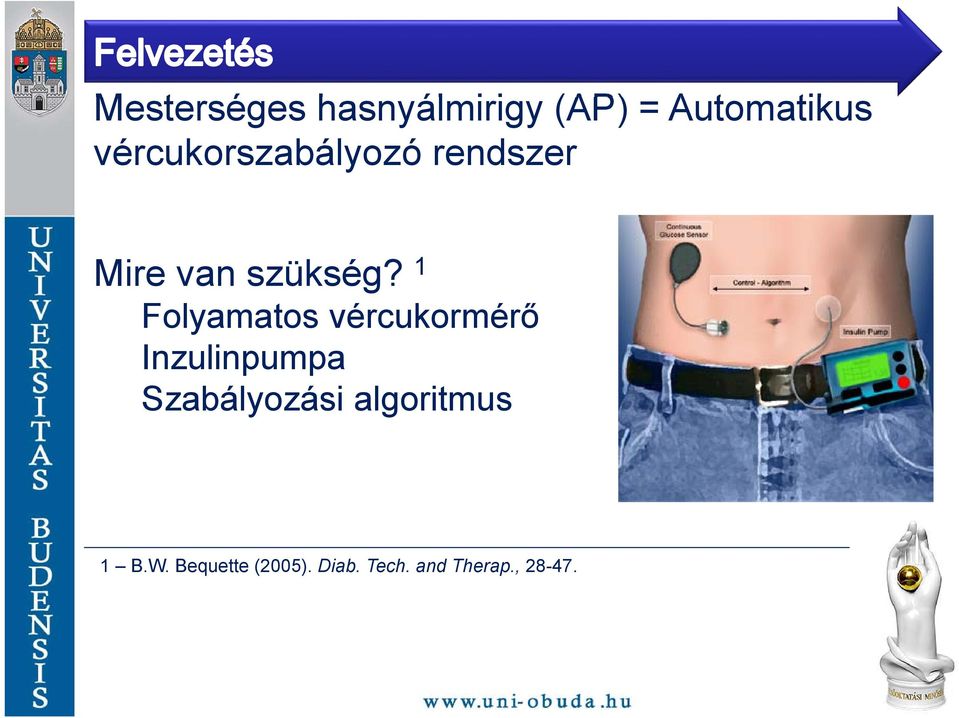 1 Folyamatos vércukormérő Inzulinpumpa Szabályozási