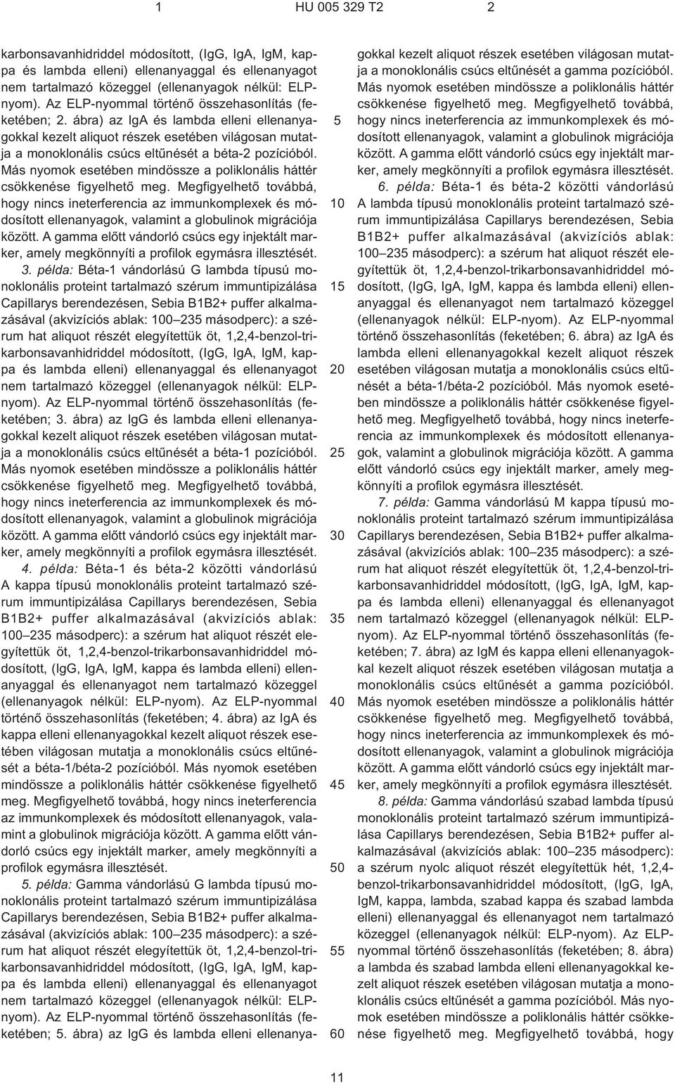 ábra) az IgA és lambda elleni ellenanyagokkal kezelt aliquot részek esetében világosan mutatja a monoklonális csúcs eltûnését a béta¹2 pozícióból.