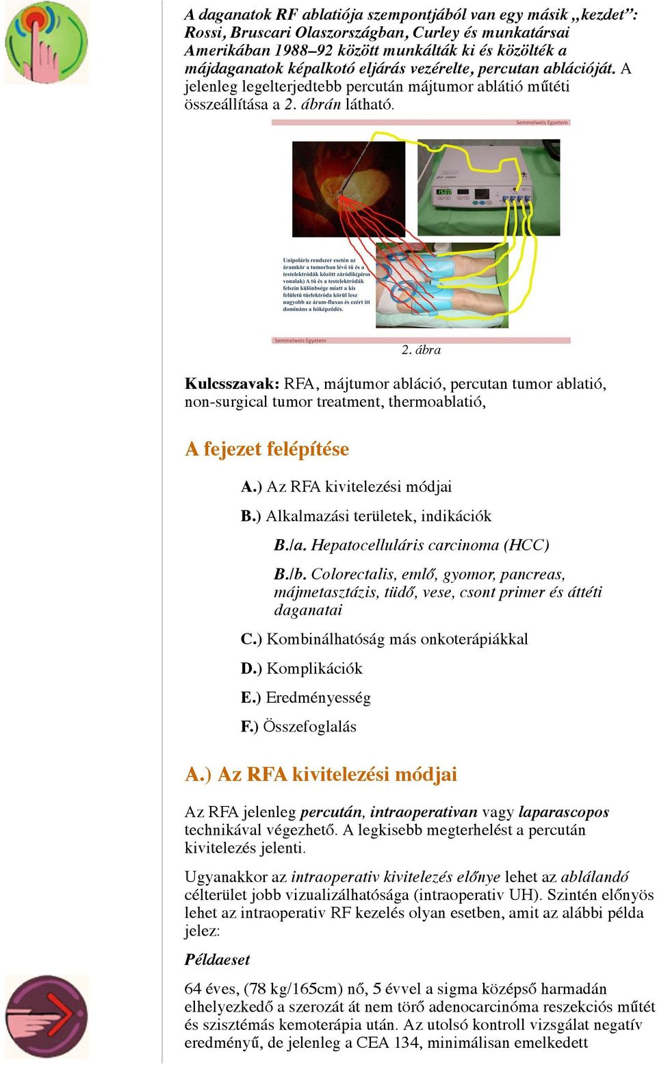 ábrán látható. 2. ábra Kulcsszavak: RFA, májtumor abláció, percutan tumor ablatió, non-surgical tumor treatment, thermoablatió, A fejezet felépítése A.) Az RFA kivitelezési módjai B.