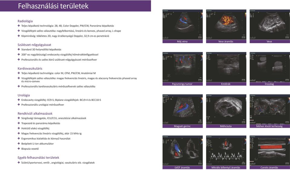 hőmérsékletfigyeléssel Professzionális és széles körű szülészet-nőgyógyászati mérőszoftver Kardiovaszkuláris Teljes képalkotó technológia: color M, CFM, PW/CW, Anatómiai M Vizsgálófejek széles