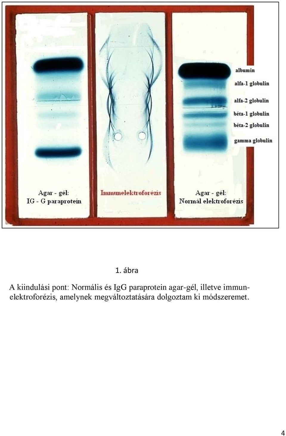 immunelektroforézis, amelynek