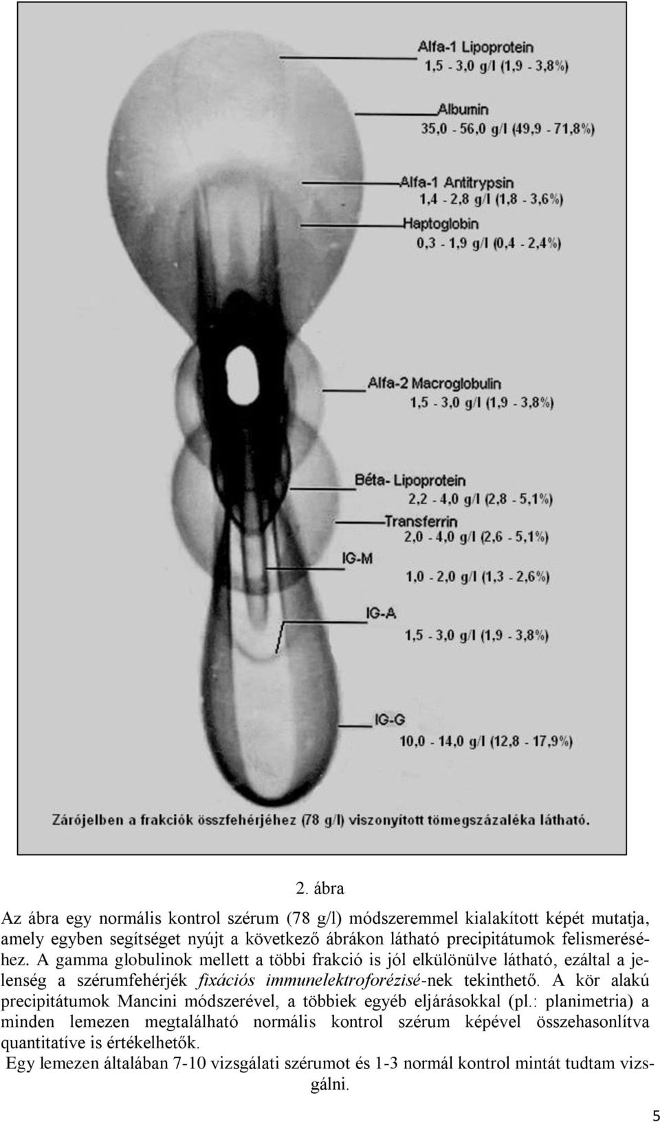 A gamma globulinok mellett a többi frakció is jól elkülönülve látható, ezáltal a jelenség a szérumfehérjék fixációs immunelektroforézisé-nek tekinthető.