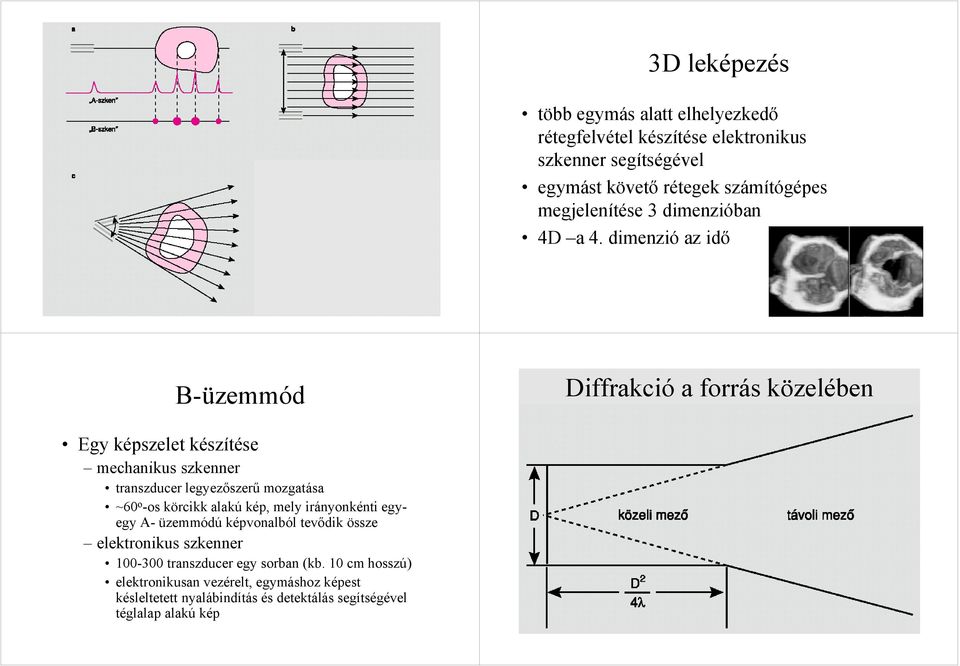 dimenzió az idő B-üzemmód Dirakió a orrás közelében Egy képszelet készítése mehanikus szkenner transzduer legyezőszerű mozgatása ~60 o -os