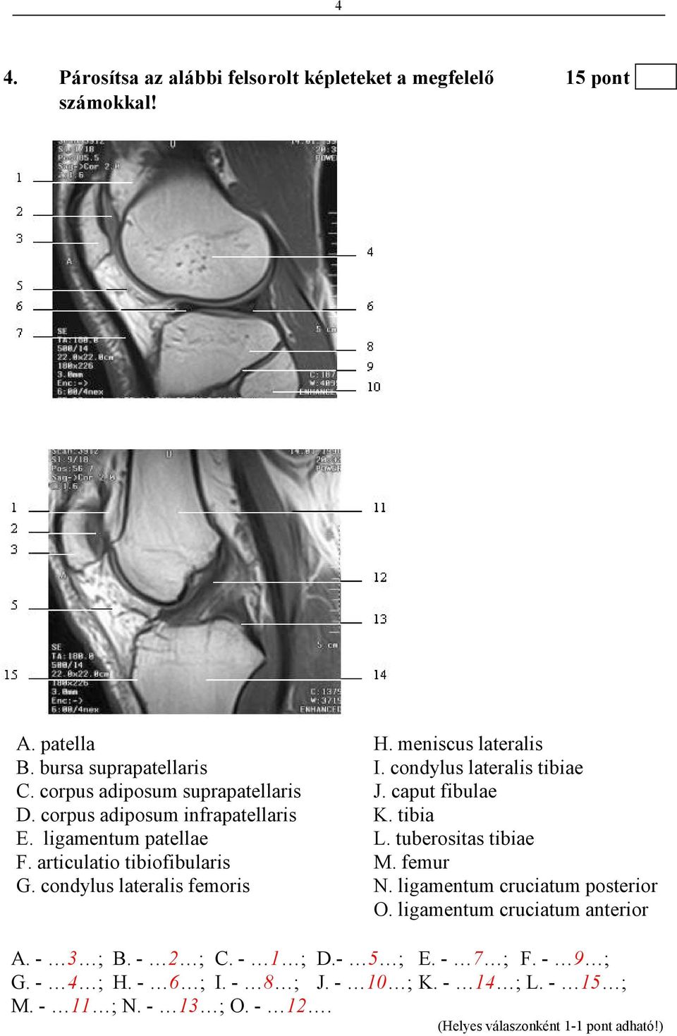 ligamentum patellae L. tuberositas tibiae F. articulatio tibiofibularis M. femur G. condylus lateralis femoris N.