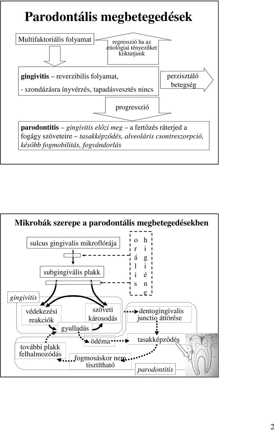 csontreszorpció, késıbb fogmobilitás, fogvándorlás Mikrobák szerepe a parodontális megbetegedésekben sulcus gingivalis mikroflórája subgingivális plakk gingivitis