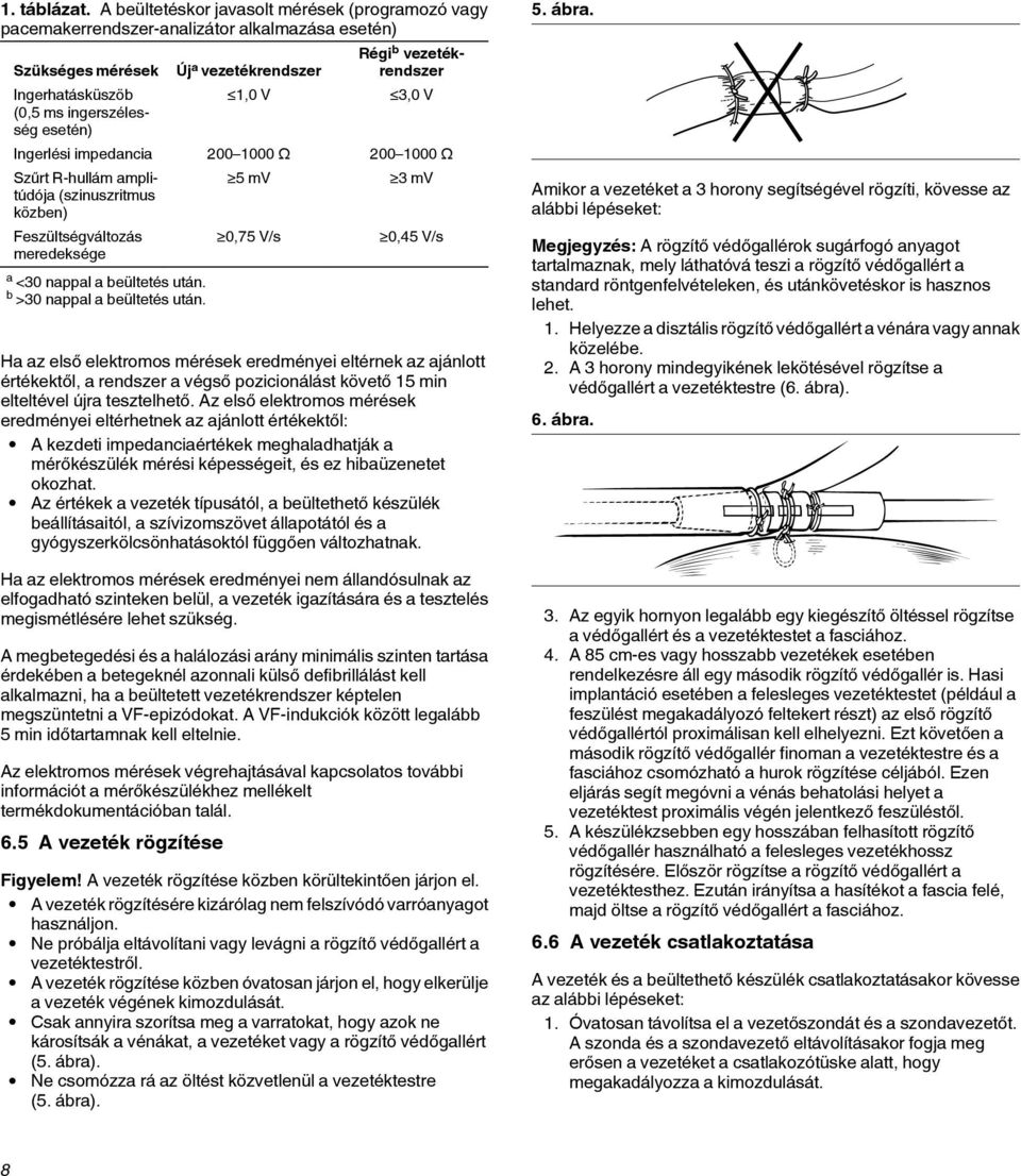 vezetékrendszer 1,0 V 3,0 V Ingerlési impedancia 200 1000 Ω 200 1000 Ω Szűrt R-hullám amplitúdója (szinuszritmus közben) Feszültségváltozás meredeksége a <30 nappal a beültetés után.