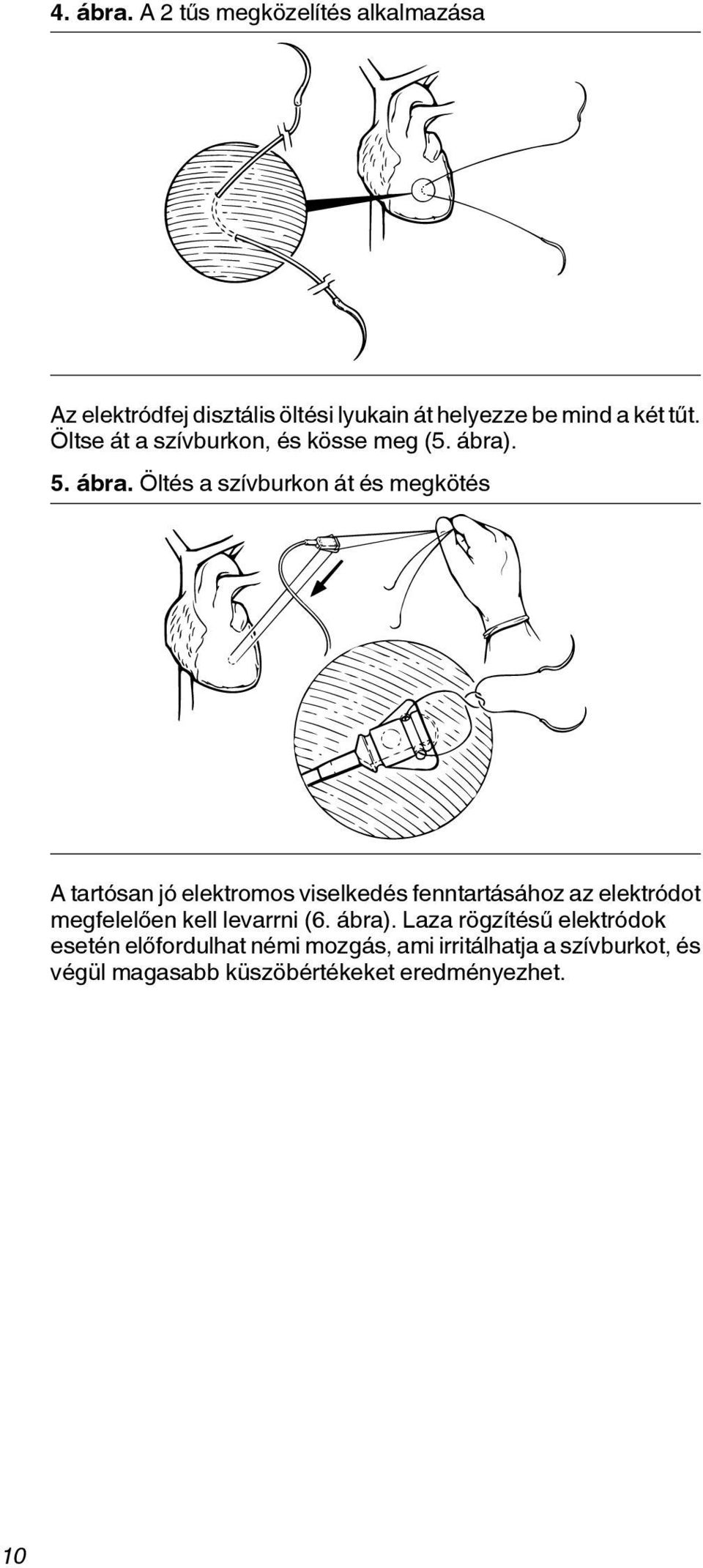 . 5. ábra.