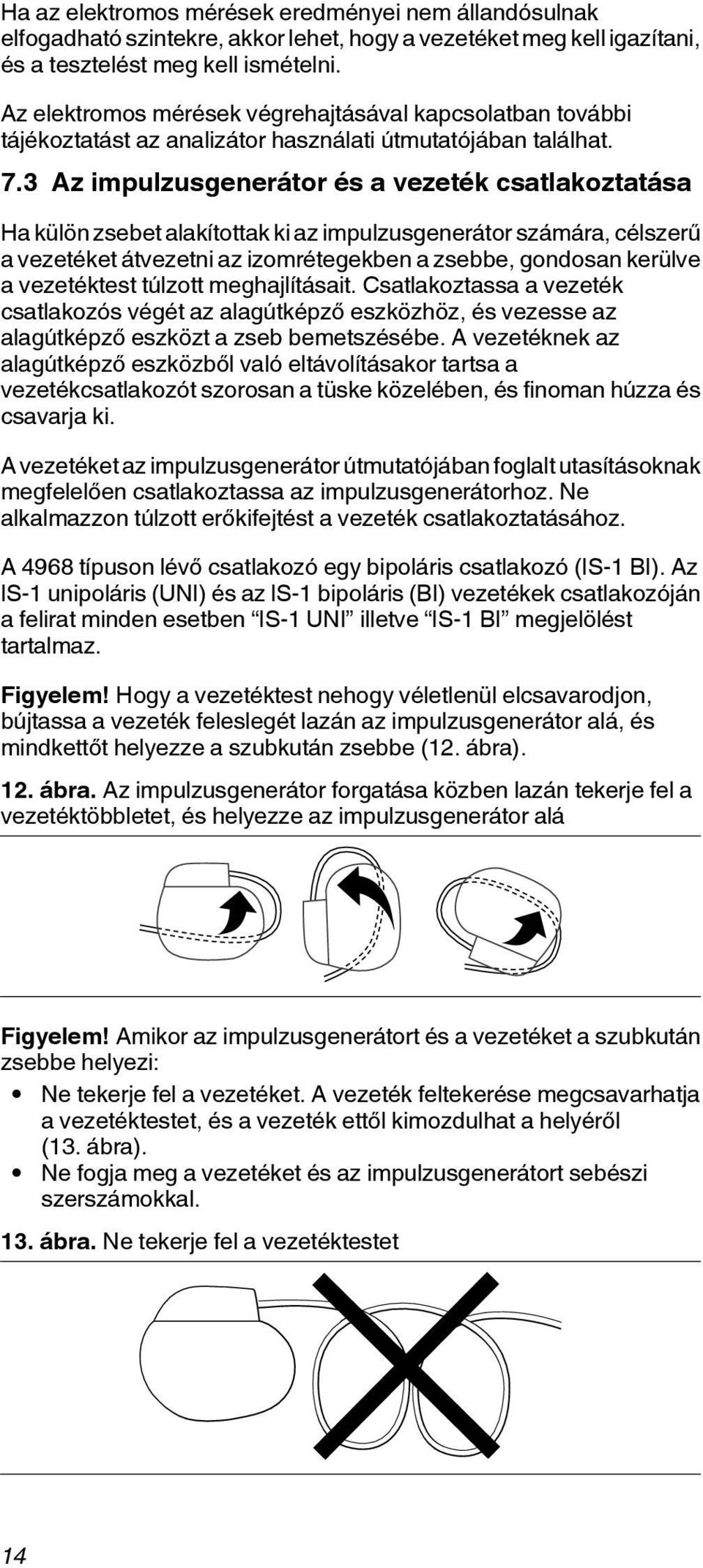 3 Az impulzusgenerátor és a vezeték csatlakoztatása Ha külön zsebet alakítottak ki az impulzusgenerátor számára, célszerű a vezetéket átvezetni az izomrétegekben a zsebbe, gondosan kerülve a