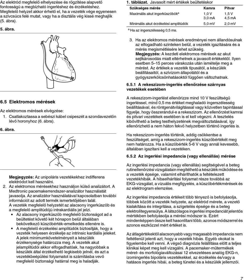 Javasolt mért értékek beültetéskor Szükséges mérés Kamra Pitvar Maximális akut ingerküszöbök a 1,0 V 3,0 ma 1,5 V 4,5 ma Minimális akut érzékelési amplitúdók 5,0 mv 2,0 mv a Ha az ingerszélesség 0,5