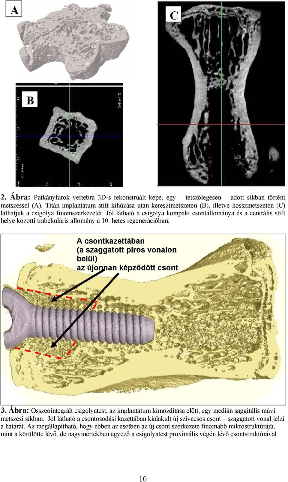 Jól látható a csigolya kompakt csontállománya és a centrális stift helye közötti trabekuláris állomány a 10. hetes regenerációban.