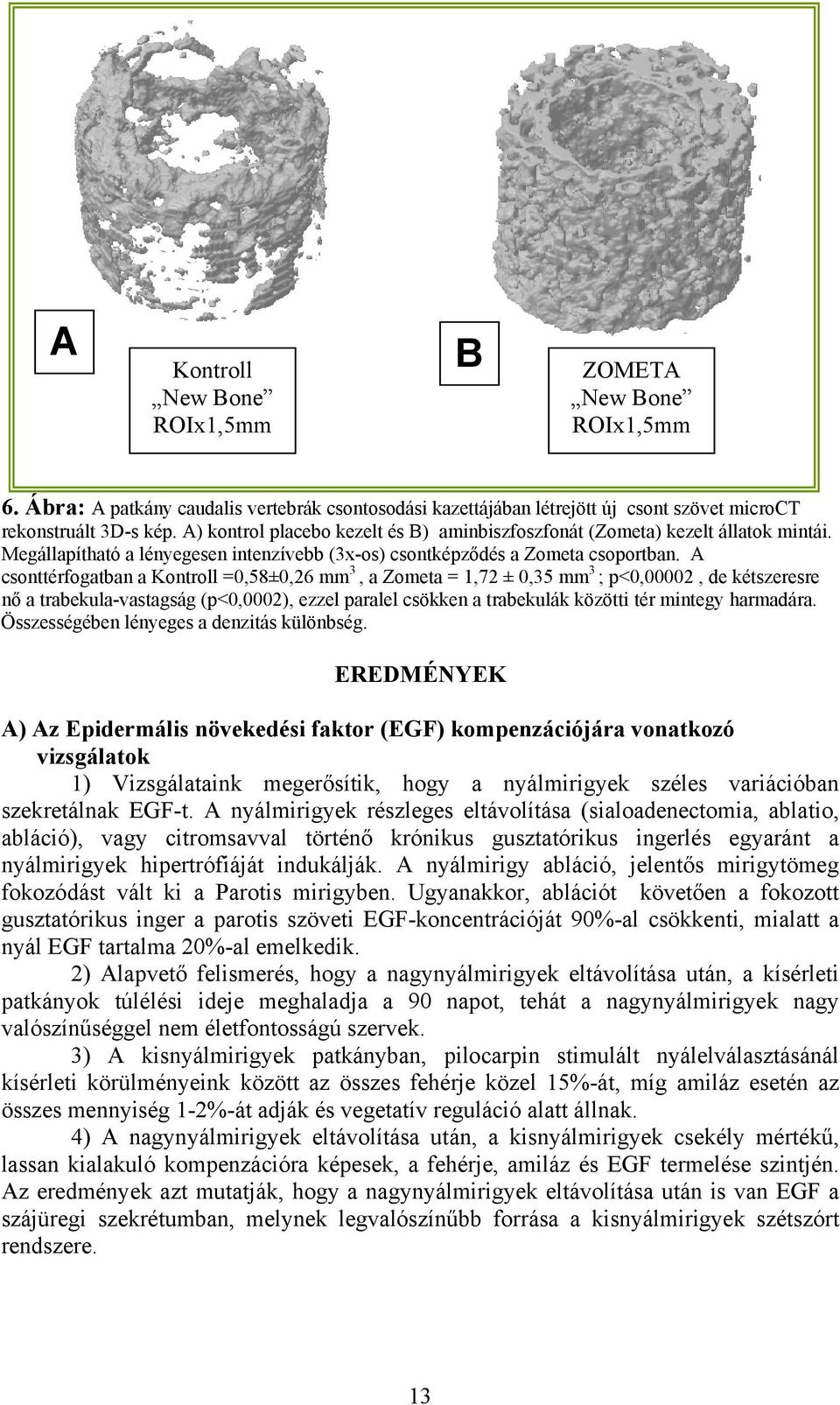 A csonttérfogatban a Kontroll =0,58±0,26 mm 3, a Zometa = 1,72 ± 0,35 mm 3 ; p<0,00002, de kétszeresre nő a trabekula-vastagság (p<0,0002), ezzel paralel csökken a trabekulák közötti tér mintegy