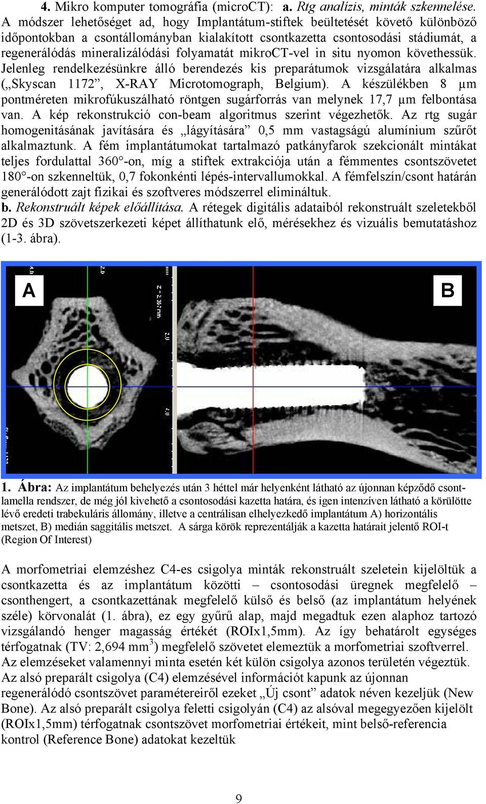 folyamatát mikroct-vel in situ nyomon követhessük. Jelenleg rendelkezésünkre álló berendezés kis preparátumok vizsgálatára alkalmas ( Skyscan 1172, X-RAY Microtomograph, Belgium).