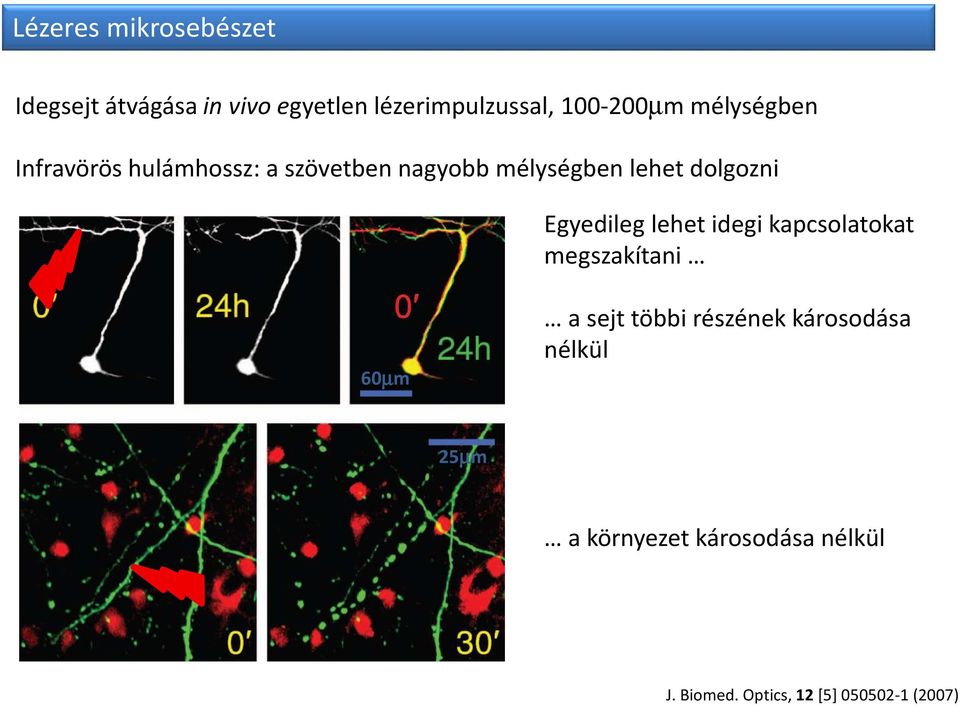 dolgozni Egyedileg lehet idegi kapcsolatokat megszakítani 60µm a sejt többi