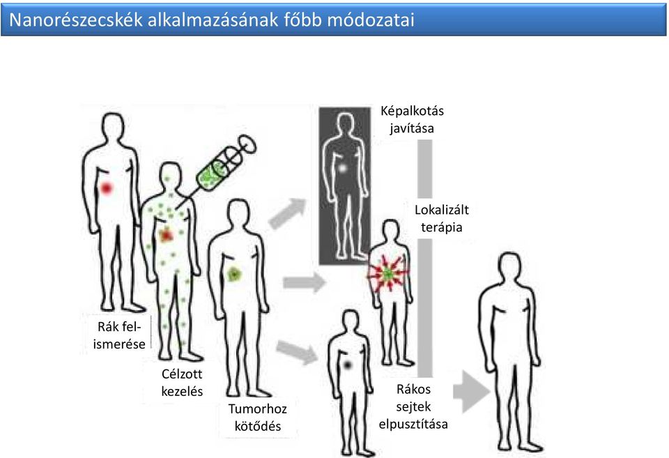 Lokalizált terápia Rák felismerése