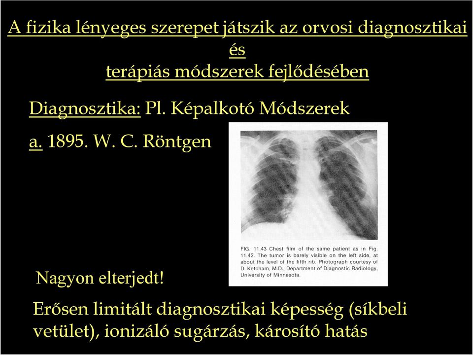 Képalkotó Módszerek a. 1895. W. C. Röntgen Nagyon elterjedt!