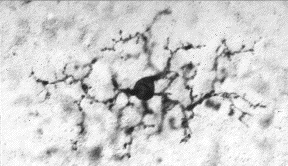 Mikroglia aktiváció nyugvó resting aktivált (Bal) GFP+ mikroglia neuronok