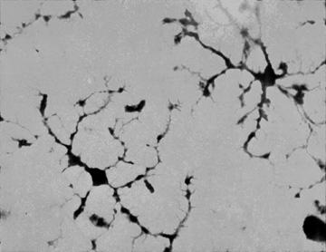 Mikroglia nyugvó mikroglia ramified nyúlványos, nyugvó fenotípus részben neuronális szignálok (pl CX3Cchemokine ligand 1