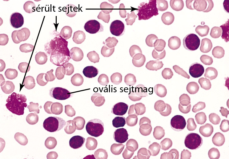 Vérkenet készítése forrás: http://ttktamop.elte.hu/onlinetananyagok/szovettani_es_sejtbiologiai_vizsgalomodszerek/ch02s02.html Vérkenet készítése (A C) és eredménye (D).