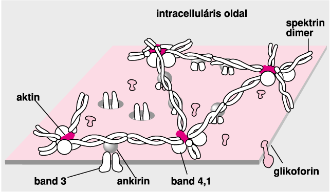 Hereditary spherocytosis (HS; top panel); nonhemolytic hereditary