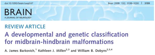 Alobaris holoprosencephalia Lobaris holoprosencephalia Azygos arteria cerebri anterior Corticalis keresztezi a középvonalat fekete nyilak: fuzionált basalis ganglionok fehér nyilak: fuzionált