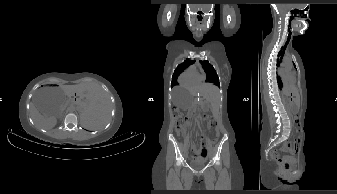 Tomográa 2/2 elvi rajza A létrehozott 3D-s objektum megjelenítése tetsz leges irányból történhet