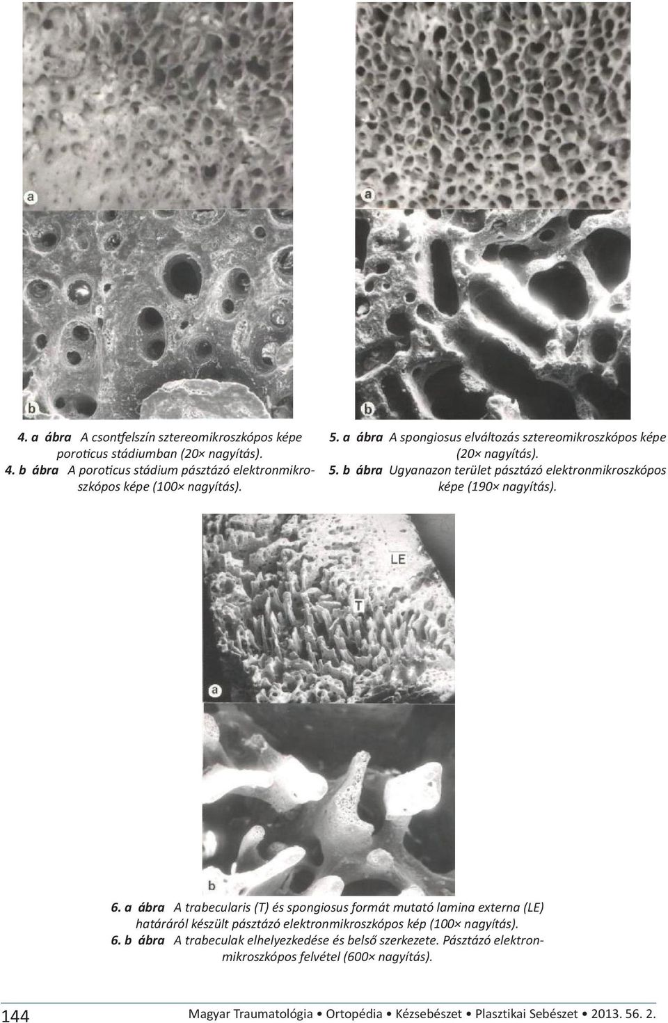 6. a ábra A trabecularis (T) és spongiosus formát mutató lamina externa (LE) határáról készült pásztázó elektronmikroszkópos kép (100 nagyítás). 6.