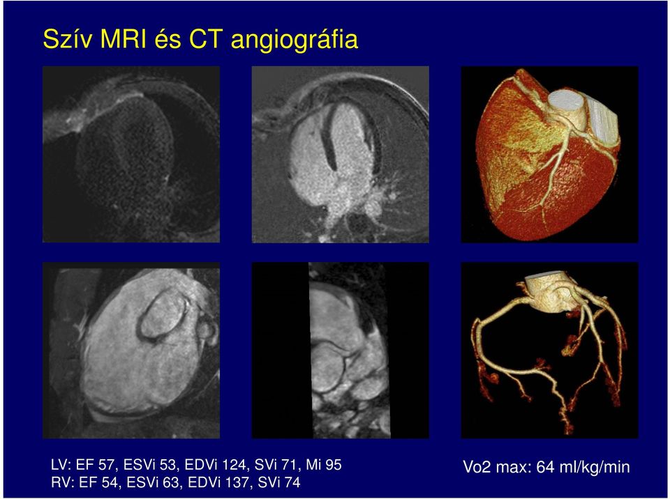 71, Mi 95 RV: EF 54, ESVi 63,