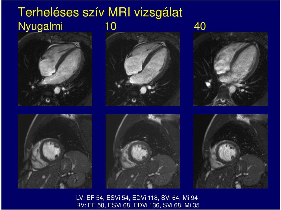 54, EDVi 118, SVi 64, Mi 94 RV: