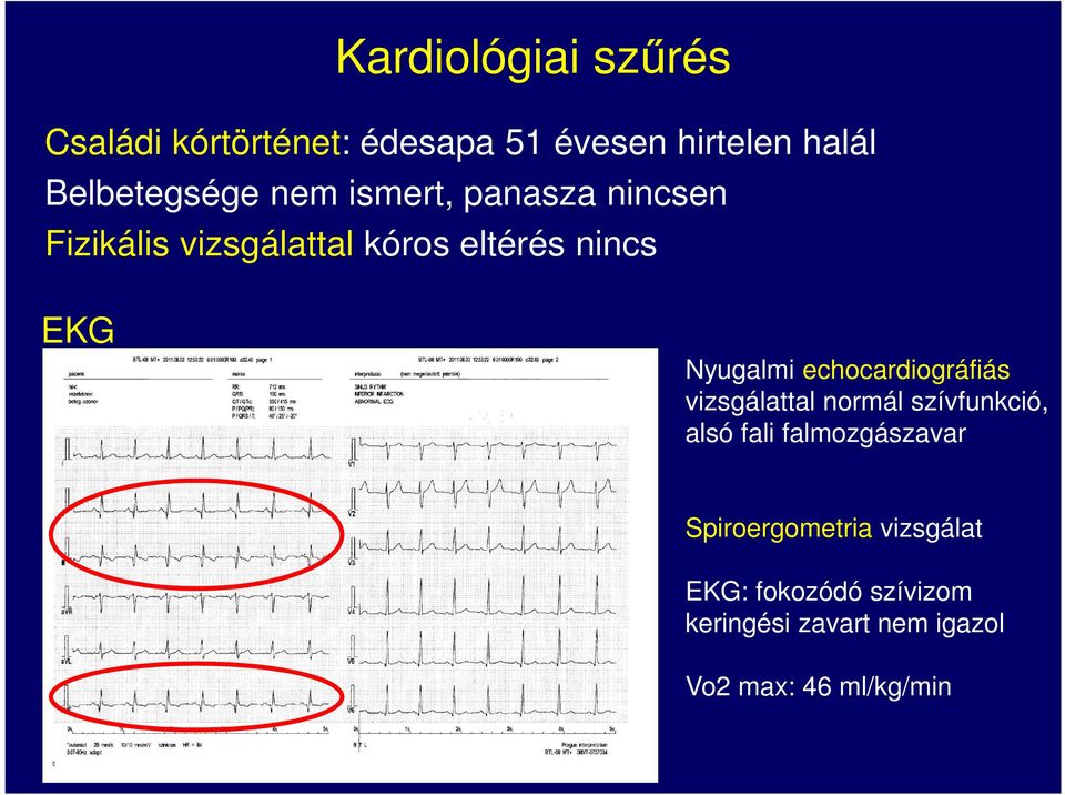 echocardiográfiás vizsgálattal normál szívfunkció, alsó fali falmozgászavar