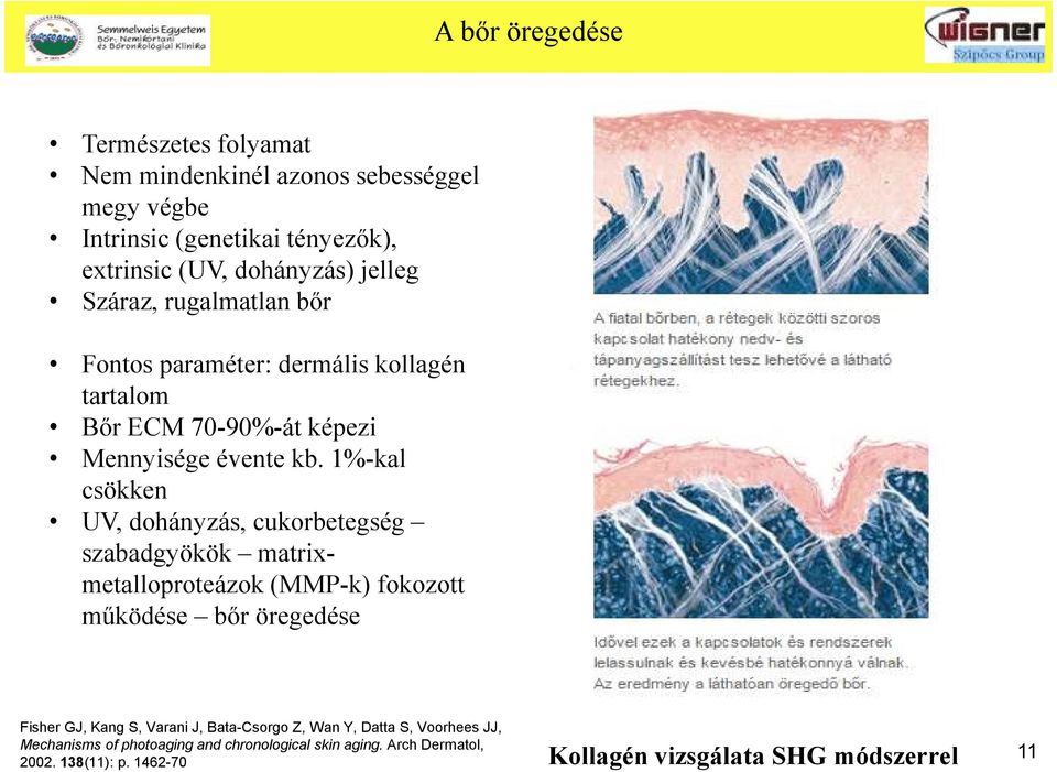 1%-kal csökken UV, dohányzás, cukorbetegség szabadgyökök matrixmetalloproteázok (MMP-k) fokozott működése bőr öregedése Fisher GJ, Kang S, Varani