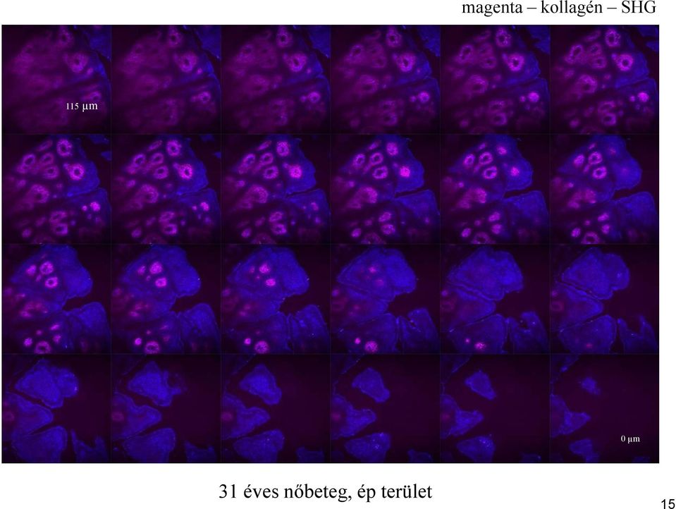 115 µm 0 µm 31