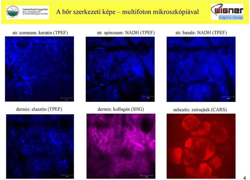 basale: NADH (TPEF) felszín z = 50-100 µm dermis: