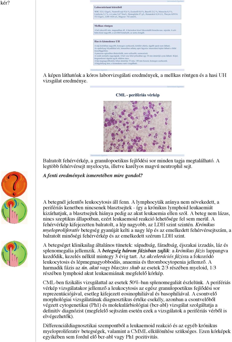 A lymphocyták aránya nem növekedett, a perifériás kenetben nincsenek blasztsejtek - így a krónikus lymphoid leukaemiát kizárhatjuk, a blasztsejtek hiánya pedig az akut leukaemia ellen szól.