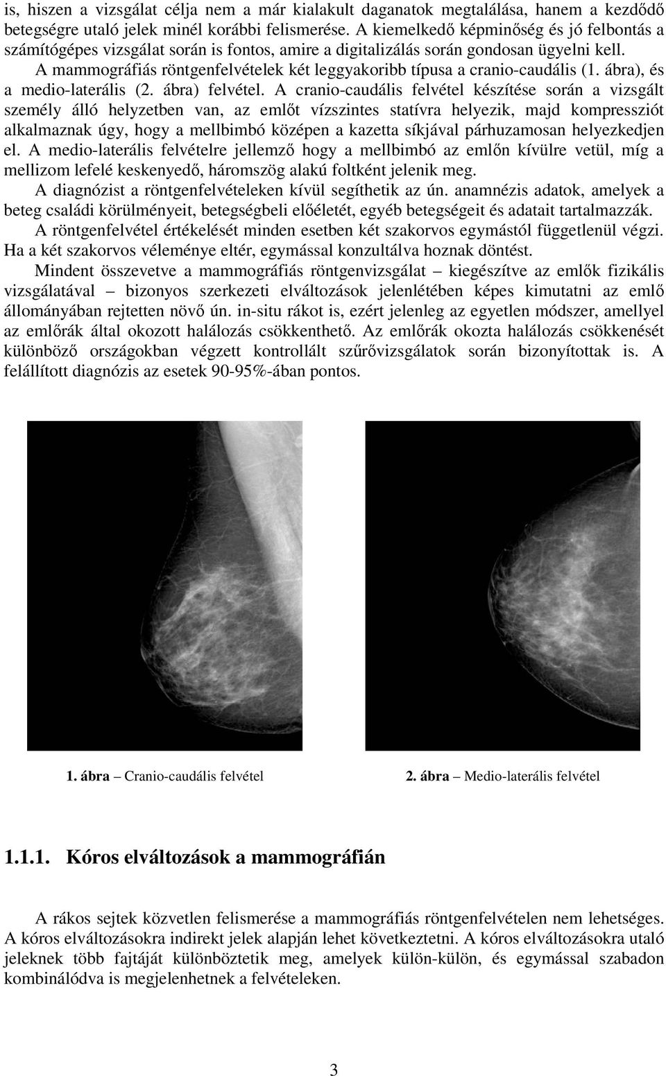A mammográfiás röntgenfelvételek két leggyakoribb típusa a cranio-caudális (1. ábra), és a medio-laterális (2. ábra) felvétel.