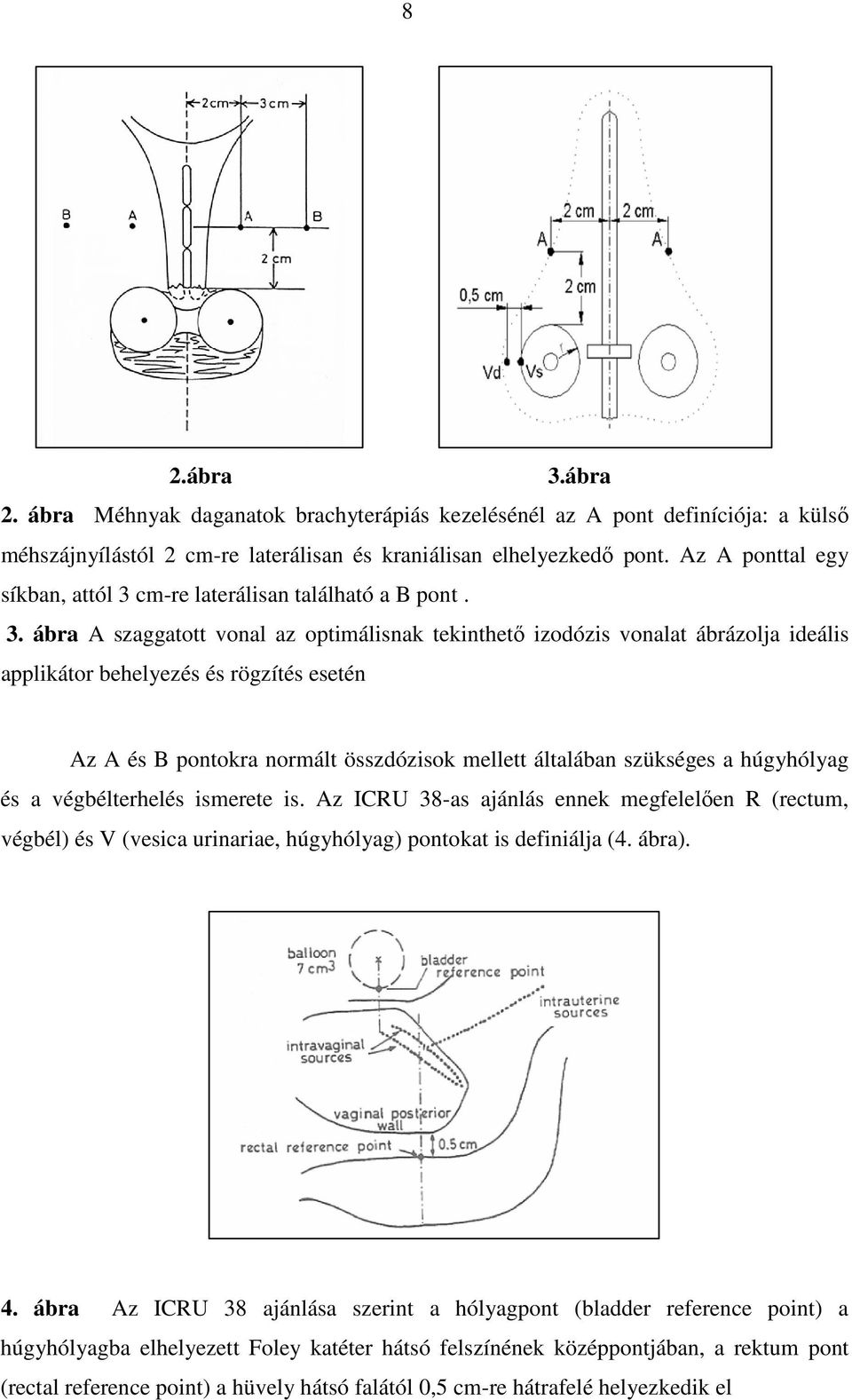 cm-re laterálisan található a B pont. 3.