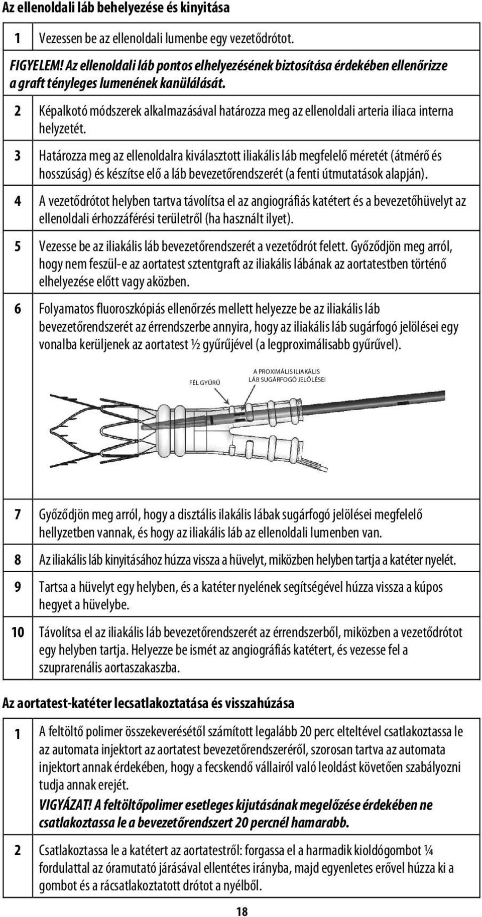 2 Képalkotó módszerek alkalmazásával határozza meg az ellenoldali arteria iliaca interna helyzetét.