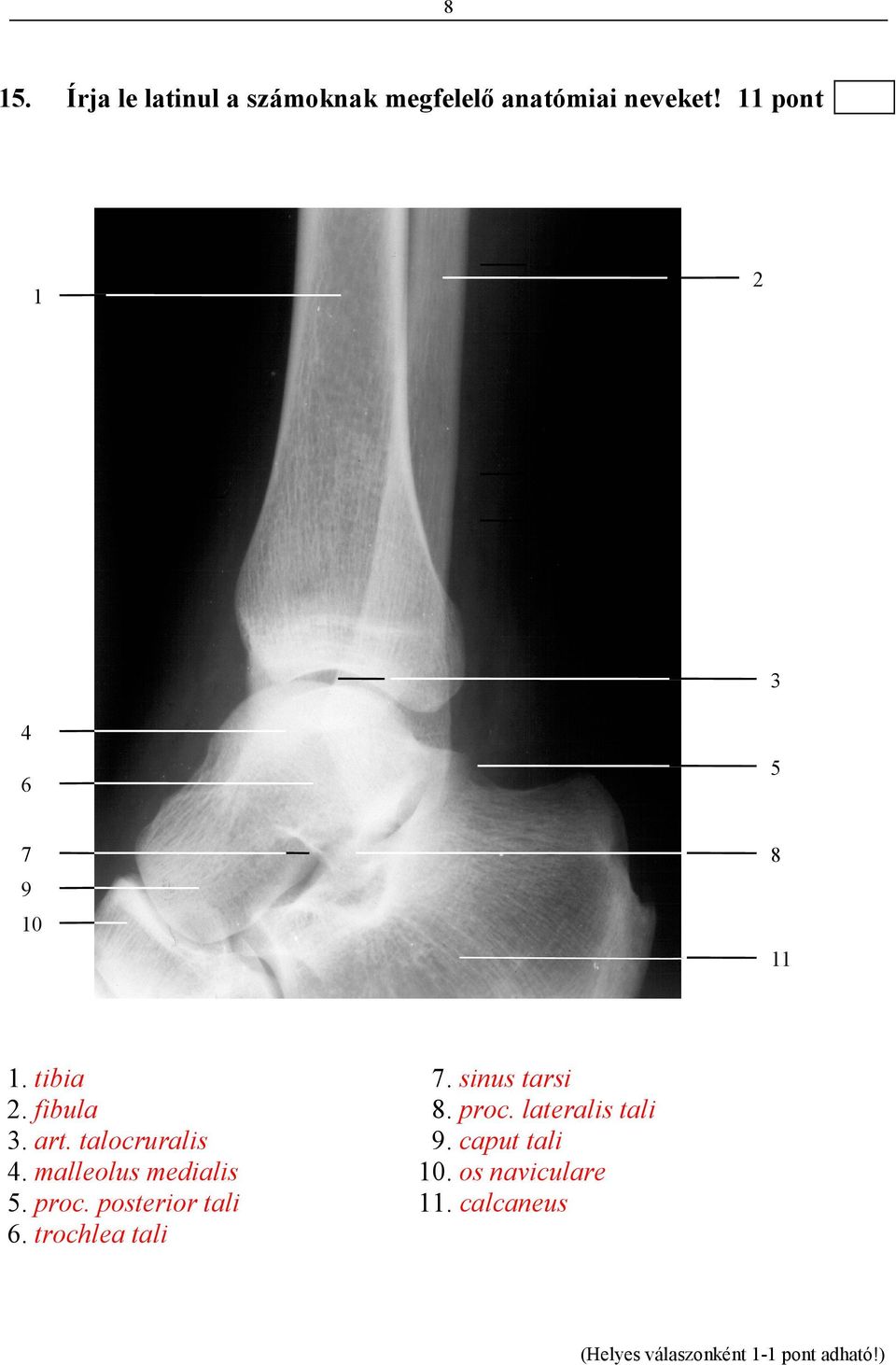 talocruralis 4. malleolus medialis 5. proc. posterior tali 6.