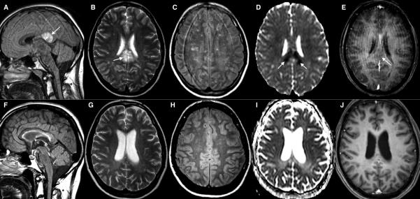 ISCHAEMIA? PRES!