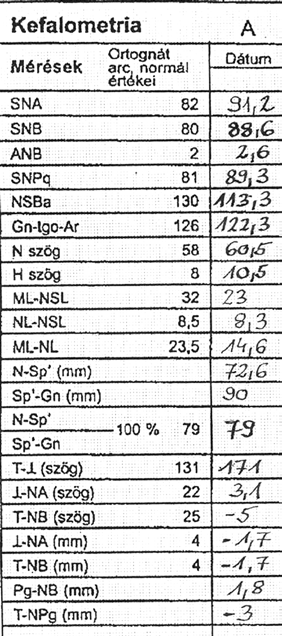 Teleröntgen-analízis tág, hiányos koponyavarratokat és hypoplasticus orrcsontot mutatott. Az NSBa és az ML-NL szög kisebb, valamint az incisalis szög nagyobb a normálisnál (4. ábra).