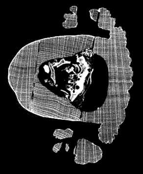 CT - Computed Tomography CT - Computed Tomography 3D képalkotó eljárások A különböző pozíciókból felvett képekből számítógéppel készítenek 3D ábrákat Többféle sugárzás használható (főként röntgen,