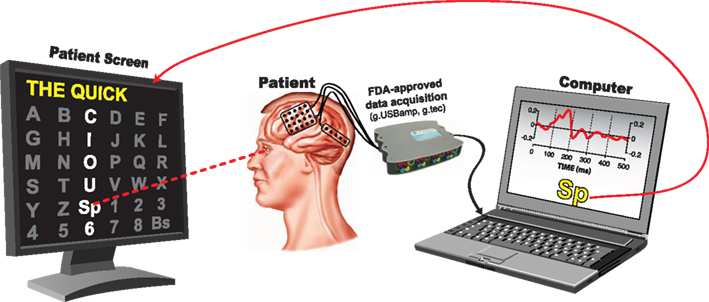Agy-számítógép interfészek (BCI) EEG jelek feldolgozása o