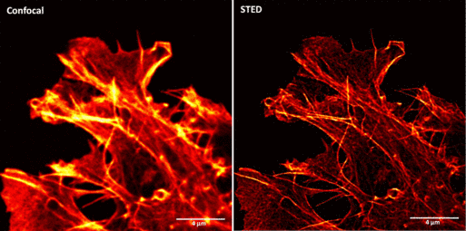 STED Aktin filamentumok Elise Stanley, Division of Genetics &