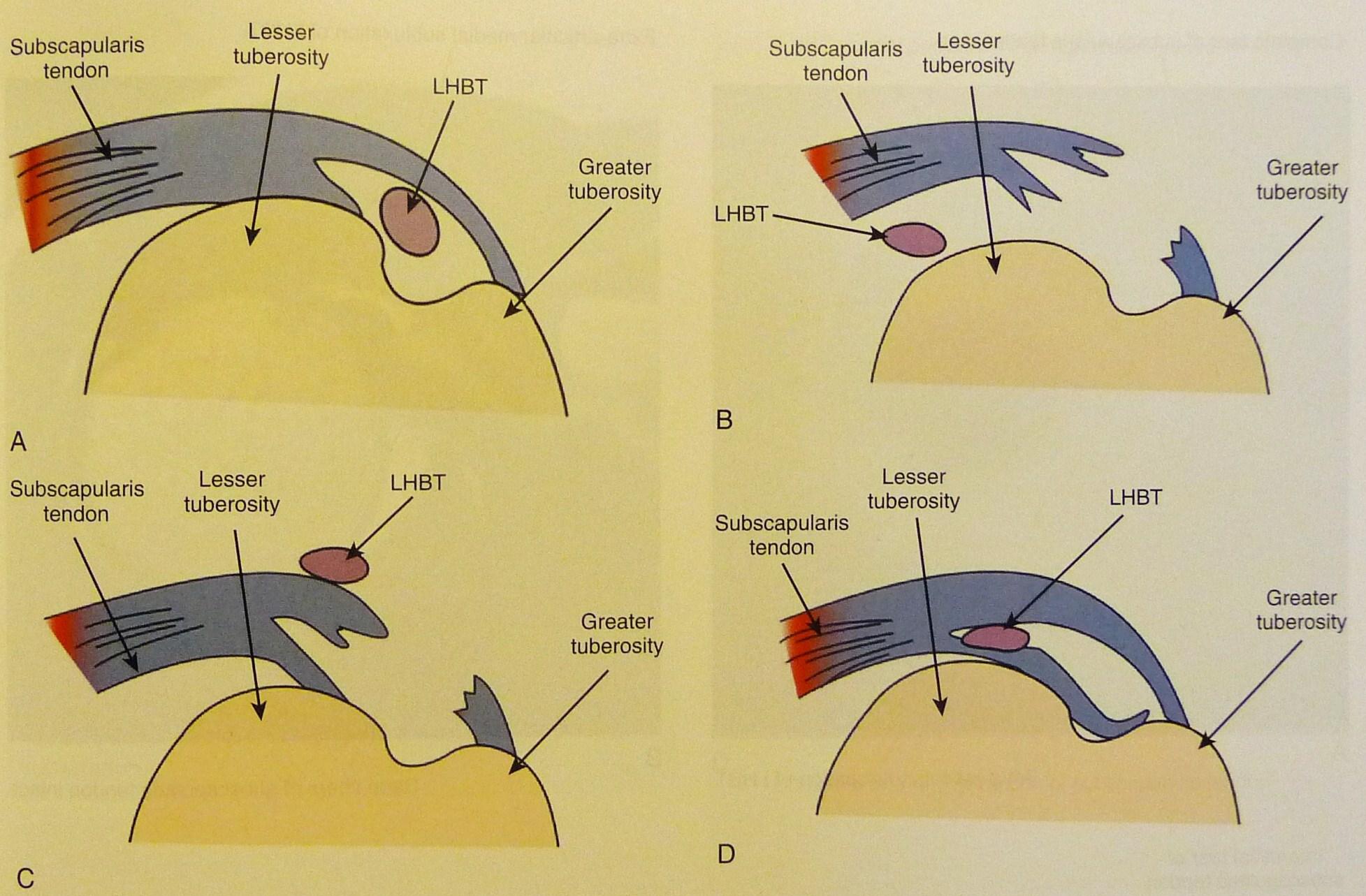 a m. biceps hosszú