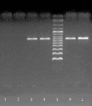 gyökerét, továbbá a # 41 hairy root klón sejtjeit. Az izolált DNS mindkét kivonat esetében jól meghatározott foltokat adott az agarózgélen (54/A. ábra, világos sávok). A PCR elvégzését követoen a D.
